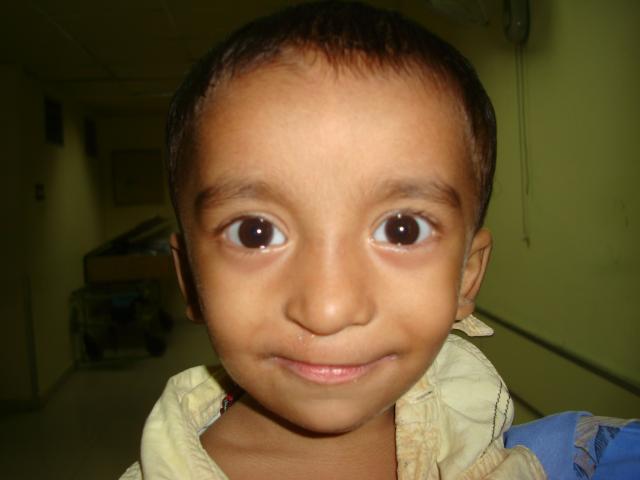 1st Post operation picture
